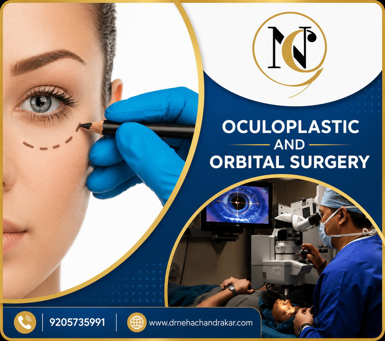 Oculoplasty, Orbit and Lacrimal Surgery in Delhi &mdash; Dr. Neha Chandrakar
